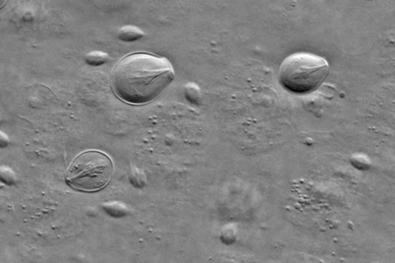 Nematocysts Hydra viridis-Ausschnitt.jpg